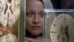 10 Things to Know About... The Brain