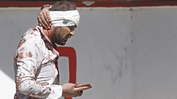 A man injured in the blast in Kabul