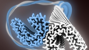 Tau tangles cause the cell damage that leads to Alzheimer's disease (pic: Thomas Martin)