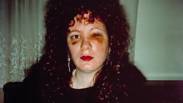 Nan Goldin - Nan one month after being battered, 1984