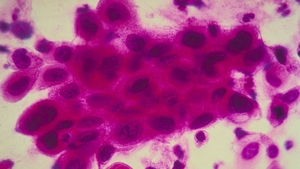 Spinning molecules activated by ultraviolet light could drill through cancer cell membranes