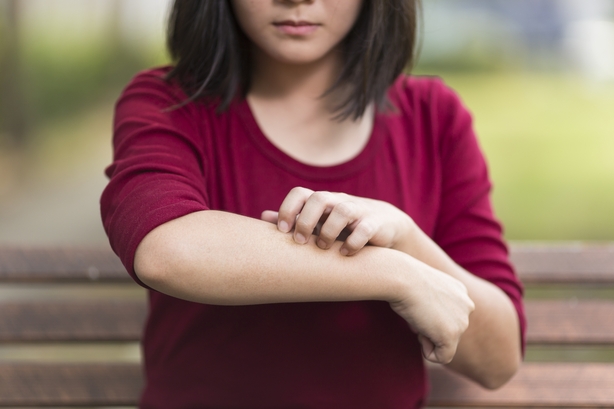 Woman Scratching Her Arm Sitting on Bench at Park