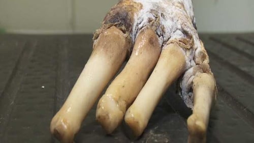 The limb was discovered on a beach near Doonbeg last week