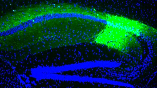 Mouse hippocampus injected with adeno-associated virus expressing green fluorescent protein
