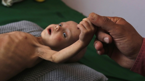 Save the Children has said opening the port and airport will be 'nowhere near enough to avert a potential famine' in Yemen