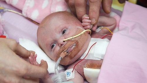 Baby born with heart outside body survives in UK