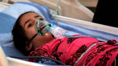A Yemeni child suffering from diphtheria in hospital in the capital Sanaa - one of the few health centres still operational