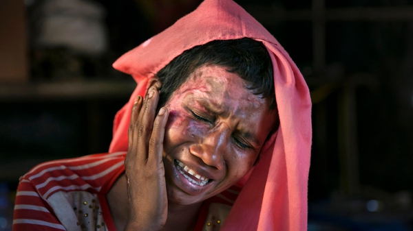Mumtaz Begum cries as she touches wounds she suffered when soldiers burned her house