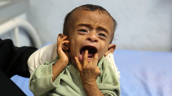 More than 11 million Yemeni children need humanitarian assistance
