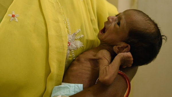 Every year, 2.6 million babies die before turning one month old