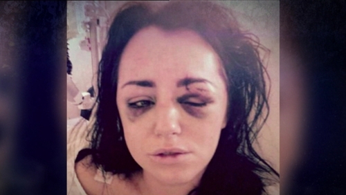 Softcore website reviews Facial abuse jessica