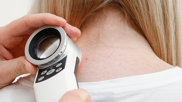 Melanoma is currently detected using a visual scan