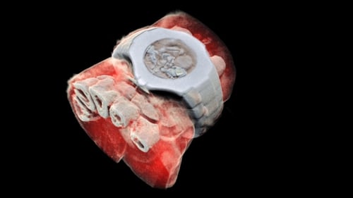 A 3D image of a wrist with a watch showing part of the finger bones in white and soft tissue in red. Photo: MARS Bioimaging Ltd