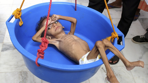 Yemen has 11.3 million children in need as the war rages on