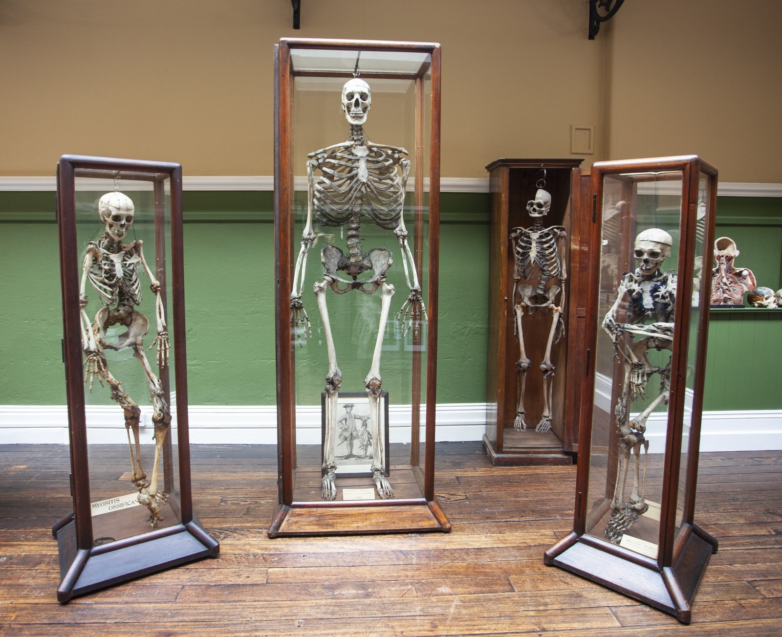 Image - The skeleton of William Magrath (center). Photo by Evi Numen.