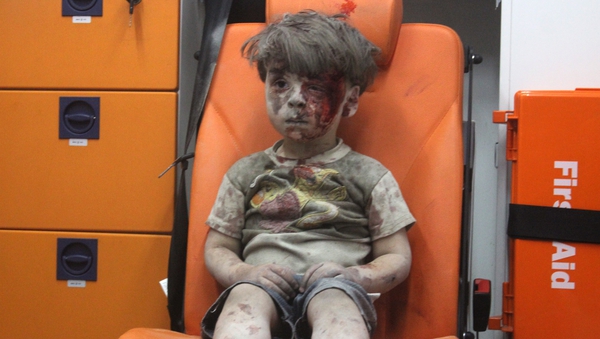 Images of an injured 5-year-old Omran Daqneesh gained international attention following an air strike in Aleppo