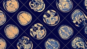How to improve and maintain brain health