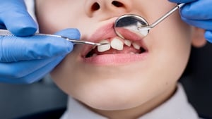 Dentists 'routinely' removing teeth from toddlers with tooth decay