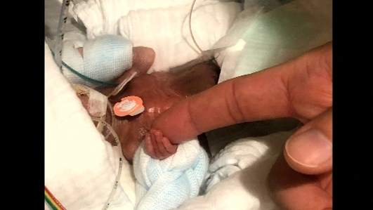 World Prematurity Day