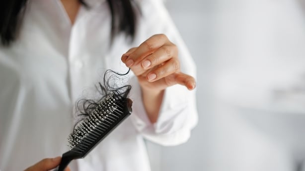 Hair loss can be caused by a number of factors (Thinkstock/PA)