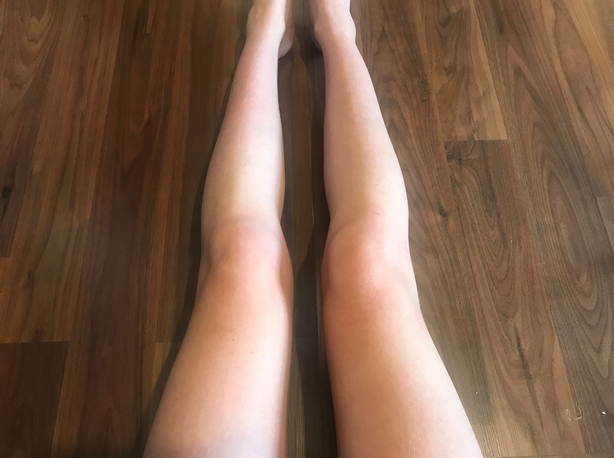 legs Before tanning (Liz Connor/PA)