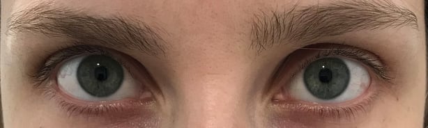 Prudence's lashes before the lift (Prudence Wade/PA)