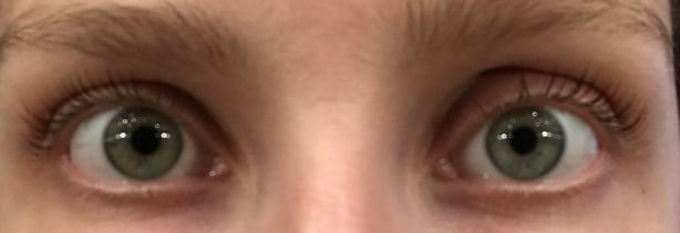 Prudence's lashes after the lift (Prudence Wade/PA)