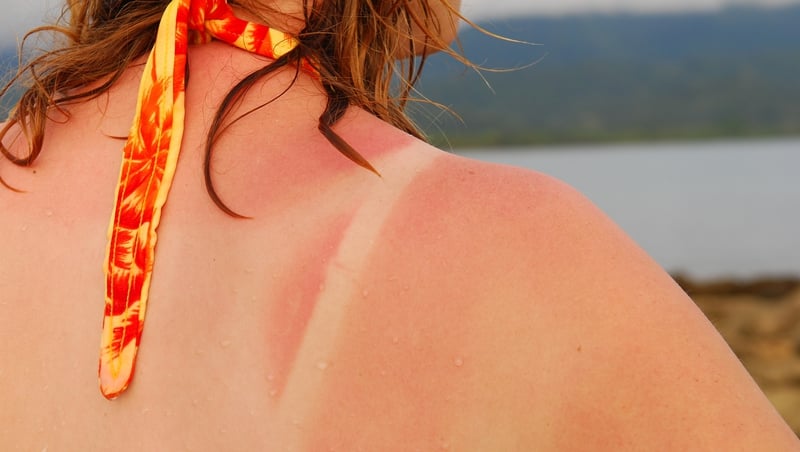 Two thirds of Irish people aren't wearing sunscreen in summer.