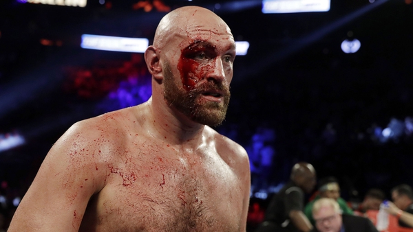 Tyson Fury will make his official WWE debut on 31 October