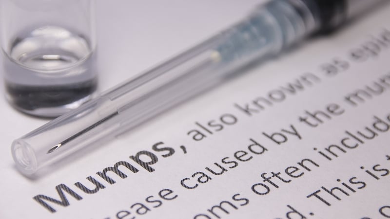 Mumps is a highly contagious viral infection, and the most common symptom of mumps is a swelling of the parotid glands