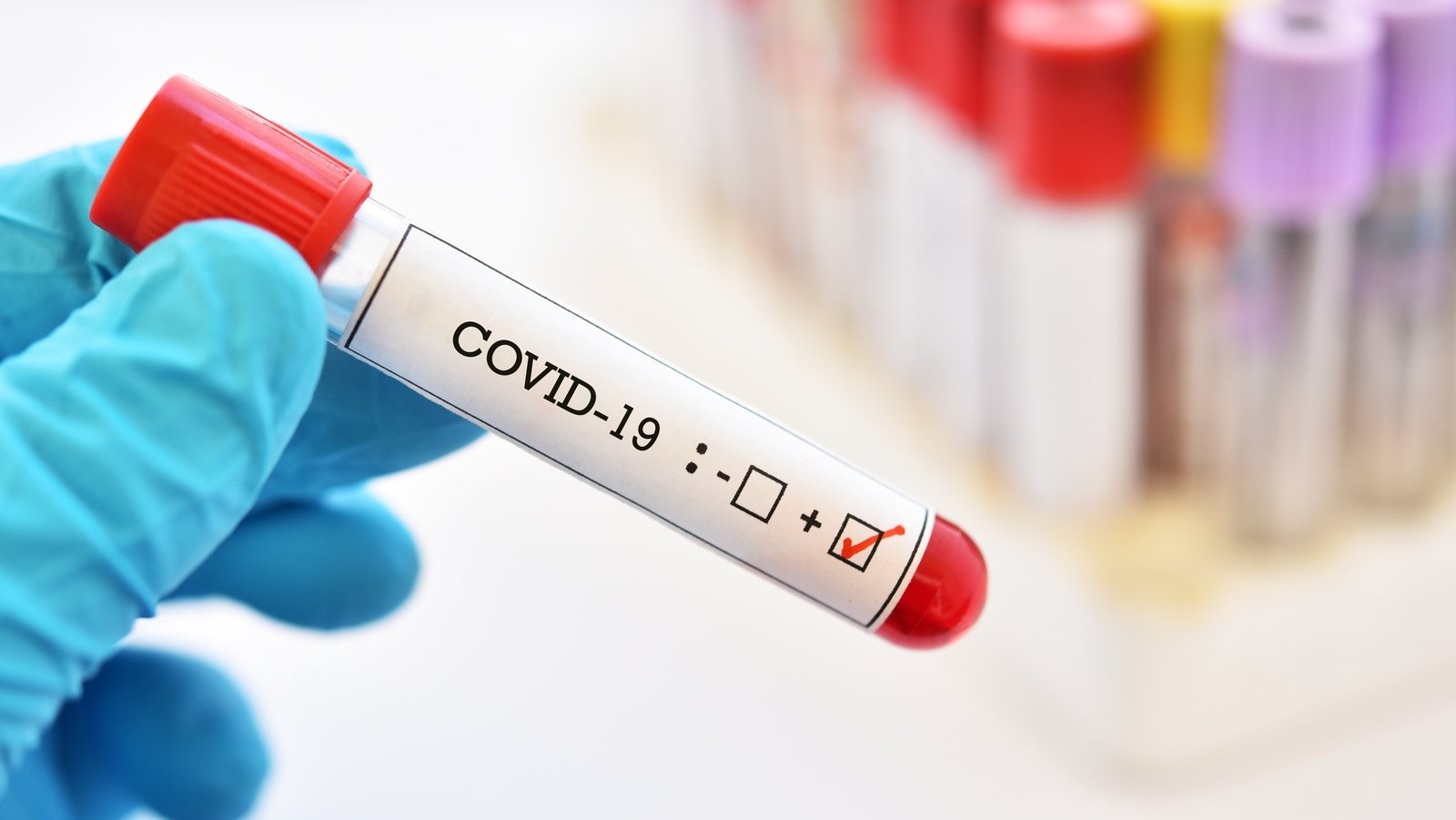 Covid-19: Two more deaths, nine additional cases