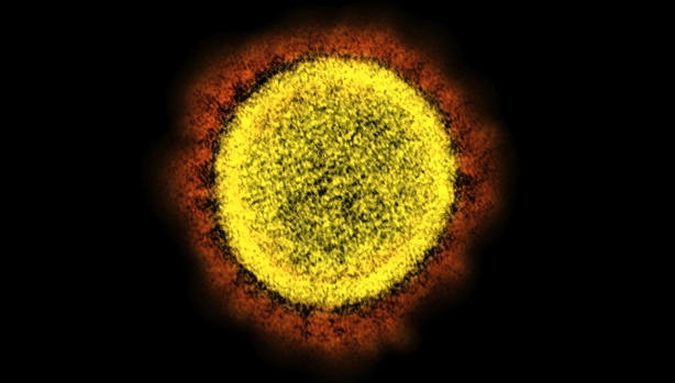SARS-CoV-2, image published by NIAID