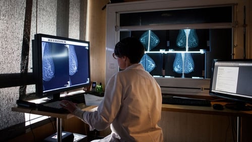 No mammograms were carried out by BreastCheck in April this year