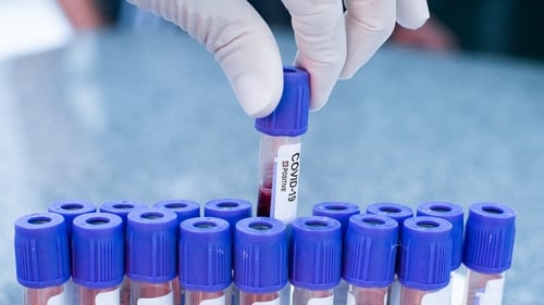 The Department of Health has confirmed nine more deaths from Covid-19