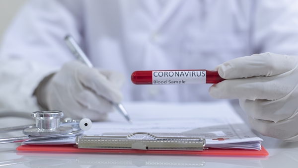 There had been 'four significant outbreaks in meat processing type facilities' across counties Kildare and Offaly