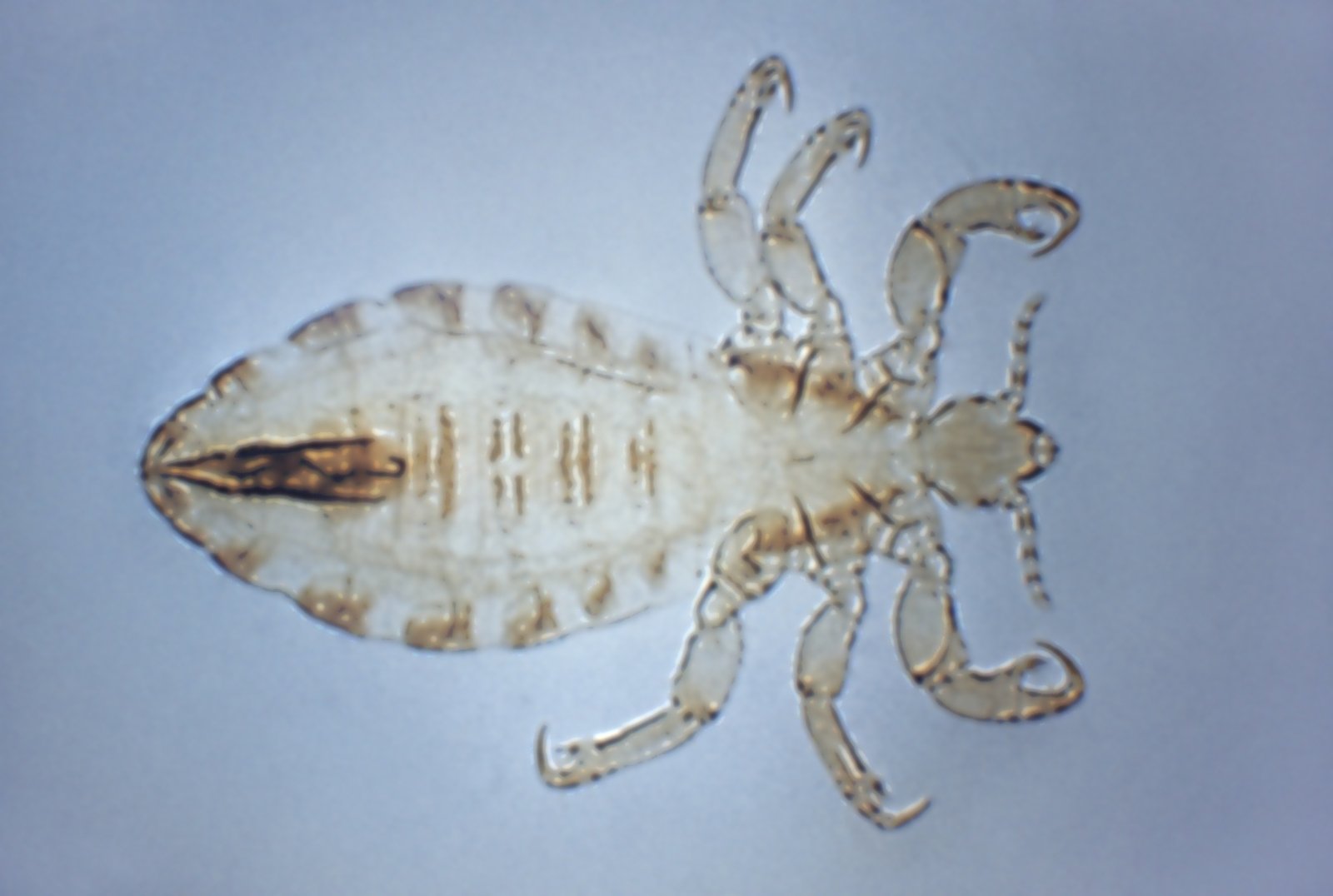 Image - Morphological characteristics of the body louse (Pediculus humanus corporis), carriers of the epidemic typhus, trench fever, and relapsing fever, 1972. Image courtesy Centers for Disease Control (CDC). Source:Collection/Gado/Getty Images