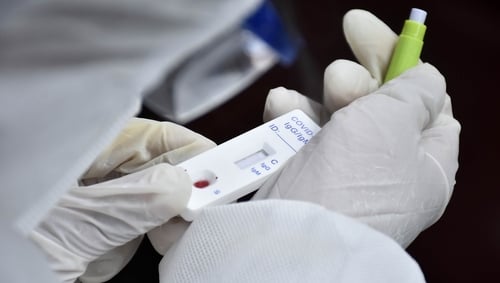 Global Death Toll From COVID-19 Tops 800,000, Says Johns Hopkins