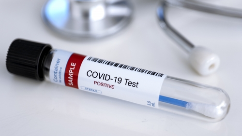 There have been 1,318 new Covid-19 cases and 75 deaths