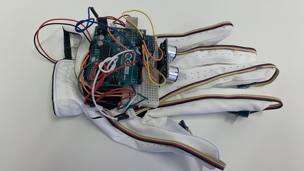 The so-called 'Jedi Glove' was developed by medics and engineers at NUI, Galway