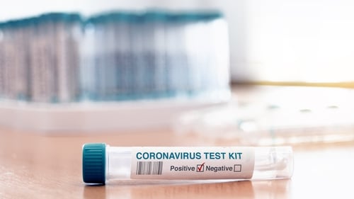 There has now been a total of 246,633 confirmed cases of Covid-19 in Ireland