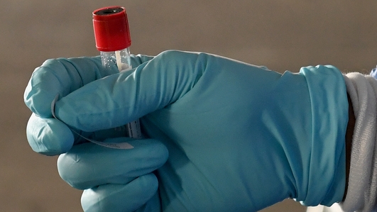 Limerick records highest daily increase of COVID-19