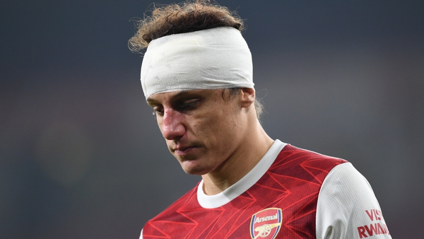 David Luiz played on against Wolves with a bandaged head
