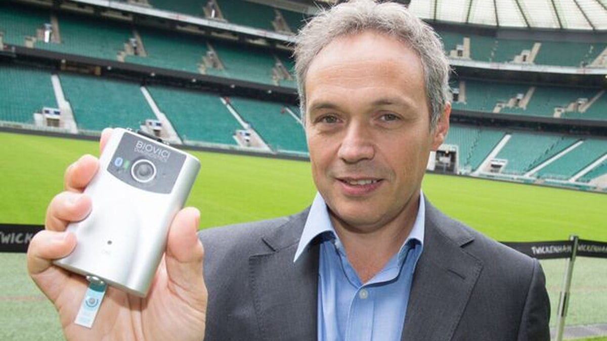 Simple diagnostic test to identify head injury from playing sport