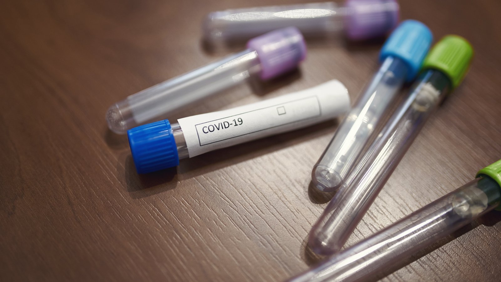 The role sugars and carbohydrates play in viruses and vaccines