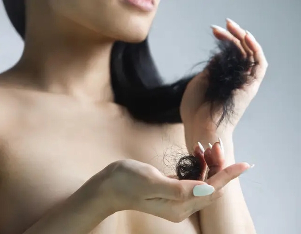 Some women might experience post-partum hair loss