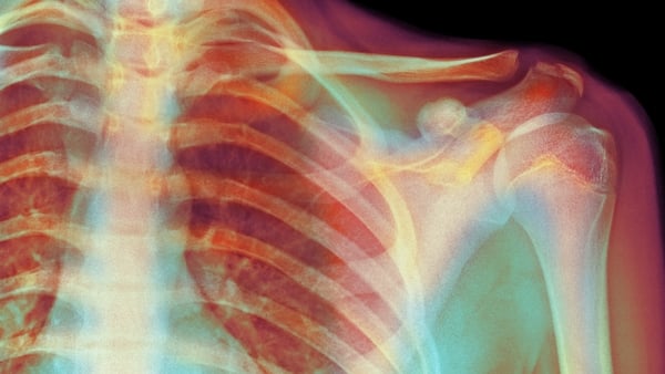 'The relationship between 'damage' on scans and pain is not a straightforward one'. Photo: Getty Images