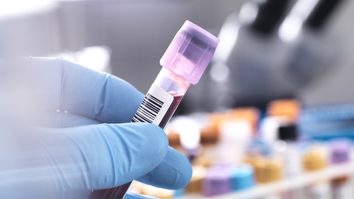 Antibody levels could determine if and when a person needs a fourth Covid vaccine