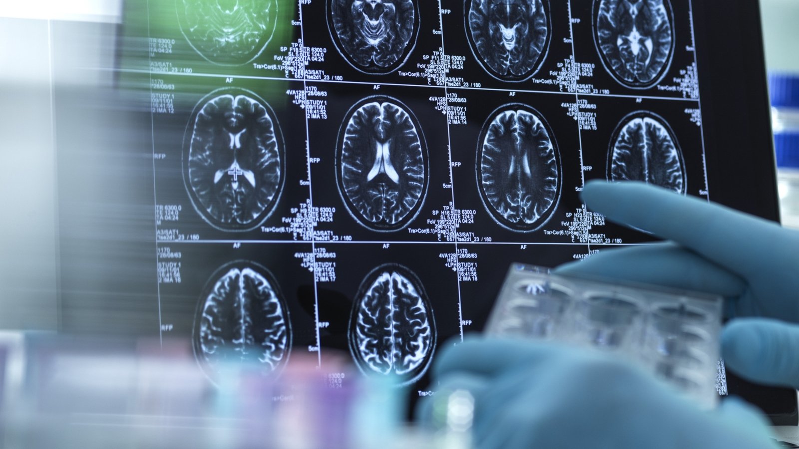 Nearly 24,000 people waiting for neurology appointment