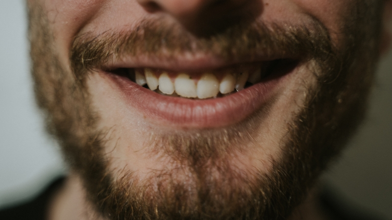 A full
          beard is advised rather than one resembling a 'badly watered
          lawn in a heatwave' (file image)