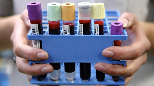 A collection of blood samples at a biobank project in Manchester. Photo: Sean Wilton/Bloomberg via Getty Images